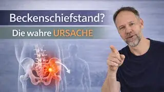 Beckenschiefstand: Die wahre Ursache, die Dir niemand sagt!