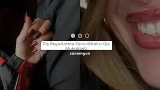 KONUŞALIM| Diş beyazlatma sürecim, kalıcı oje muhabbeti ✨