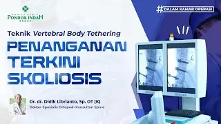 Teknik Vertebral Body Tethering (VBT) untuk Skoliosis - Dr. dr. Didik Librianto, Sp. O. T. (K)