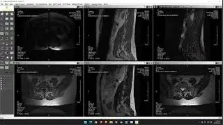 How to link views for MRI and CT exams in AmplifyPACS