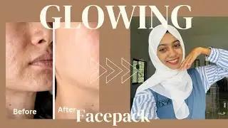 ഒറ്റ ദിവസം കൊണ്ട് നിറം വെക്കും | skin brightening facepack | 💯result