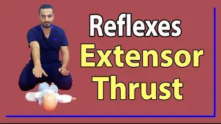 02 Extensor Thrust Reflex