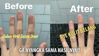 REVIEW PRODUK VIRAL TIKTOK - AMPUH MENYAMARKAN BELANG DAN BEKAS LUKA