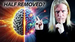 What Happens if the Right Half of the Brain is REMOVED?