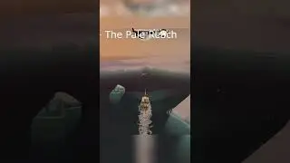 Тяжелая участь знаменитых людей...