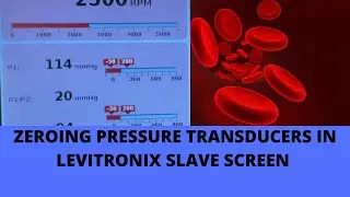 ZEROING PRESSURE TRANSDUCERS IN LEVITRONIX SLAVE SCREEN