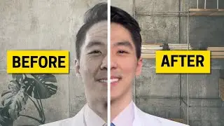 Top 5 Mistakes making you look older | Dentist Explains
