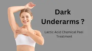 Lactic Acid Chemical Peel Treatment for Underarms | Step-by-Step Guide #graceskinacademy
