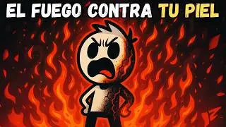 ¿Y si te quemas todo el cuerpo? (según la ciencia)