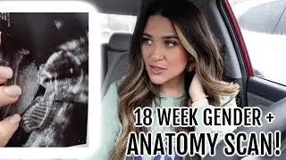 FINDING OUT IF EARLY SNEAK PEEK RESULTS WERE ACCURATE!!! 18 WEEK GENDER + ANATOMY SCAN | Liza Adele