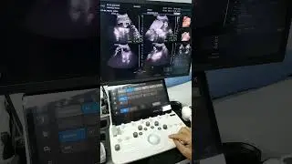 Más del Hera w10 Elite. Continuación del vídeo anterior.