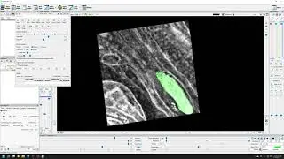 Viewing an EM stack and segmentation