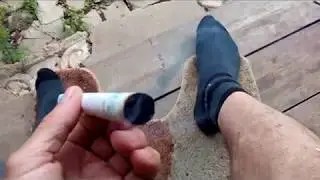 Прижигание полынными сигаретами. Моксотерапия. Личный опыт