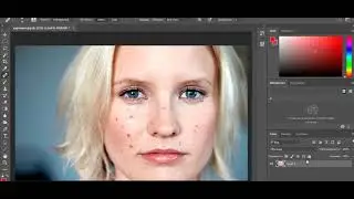 Как убрать прыщи в photoshop? Без лишних слов.
