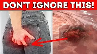 Early Warning Signs Of Colon Cancer You Should Not Ignore