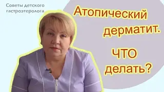 Атопический дерматит