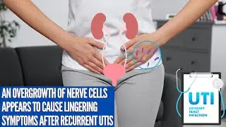 An Overgrowth of Nerve Cells Appears to Cause Lingering Symptoms After Recurrent UTIs