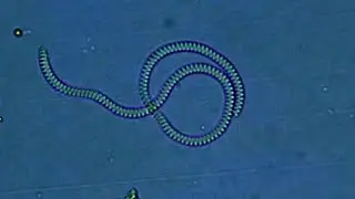The Biggest Bacterium I've Ever Seen! Possibly a Spirochaete sp.