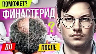 ПОБОЧКИ | ФИНАСТЕРИД ОТ ОБЛЫСЕНИЯ | Дозировки | Формы | Какую фирму выбрать? | Финастерид для волос