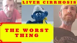 The Worst Thing About Liver Disease - Liver Cirrhosis Vlog
