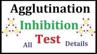 Agglutination Inhibition test (Pregnancy Test)