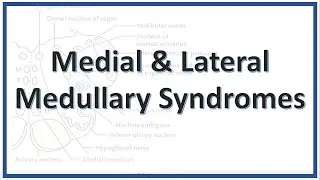 Lateral and Medullary Syndromes | Wallenberg Syndrome | PICA syndrome | Dejerine Syndrome