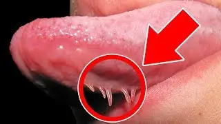 Do you have Tongue Tentacles?  Mandela Effect