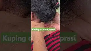 Mbah Maryono ber aksi//kuping di vonis oprasi📌 