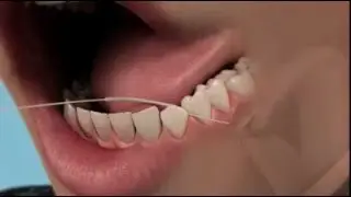 Как чистить зубные протезы