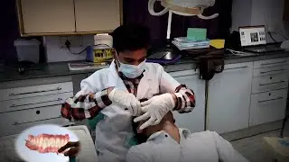 Debonding After complete Orthodontic treatment | Internship | #idst idst dental college modinagar
