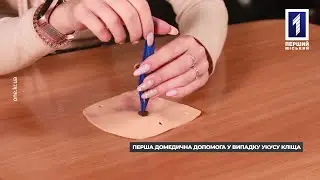 Перша домедична допомога: укус кліща