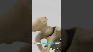 Операция века! 
