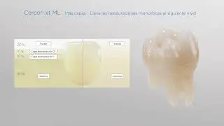 CERCON XT ML Dentsply Sirona