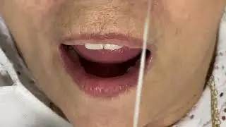Como fazer a higienização 🪥 Parte 3