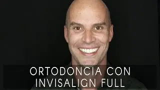 La sonrisa de Christian: ortodoncia Invisalign Full