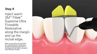 3M™ Bioclear™ - Black Triangle Animation
