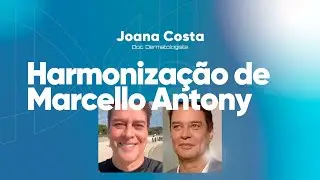 Harmonização de Marcello Antony - Dra. Joana Costa