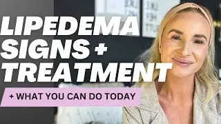 Lipedema symptoms + treatment including liposuction