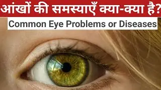 आंखों की समस्याएँ क्या-क्या है? Eye Problems होने पर हमें क्या करना चाहिए?