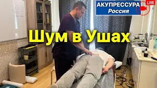 Шум в Ушах 🔴 «АКУПРЕССУРА - Россия» в эфире 