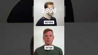 Small change, BIG impact 😎 Nicolas' hairline transplant