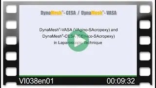 DynaMesh®-CESA /-VASA OR-Video: VAgino-SAcropexy & CErvico-SArocpexy in Laparoscopic Technique