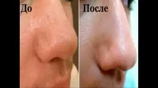Средство от черных точек