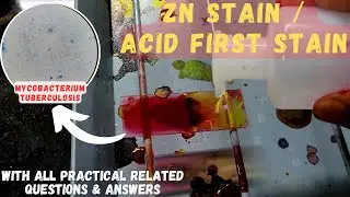 ACID FAST STAINING | Bacterial Staining Technique | Microbiology | The Chill Medico |