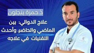 علاج الدوالي:  بين الماضي والحاضر، وأحدث التقنيات  في علاجه