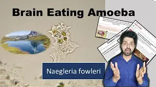 How can you be safe from Brain eating amoeba. Naegleria fowleri in Kerala By Dr Skanda Neurosurgeon