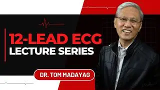 Webinar 12-lead ECG in STEMI