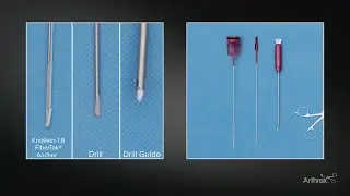 Posterior Instability With Knotless FiberTak® Soft Anchors Using Sequential Tensioning of the Repair