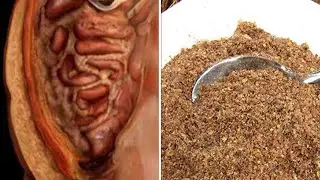 Schau, wie du Würmer und Parasiten mit 2 natürlichen Mittel beseitigt!