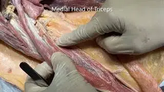 ROTATOR CUFF DELTOID TRICEPS TRIANGLES SPACES AXILLARY RADIAL ULNAR NERVES Clinicals – Sanjoy Sanyal